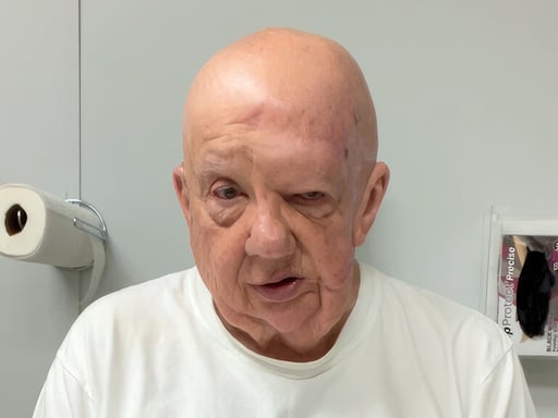 Ear Prosthesis