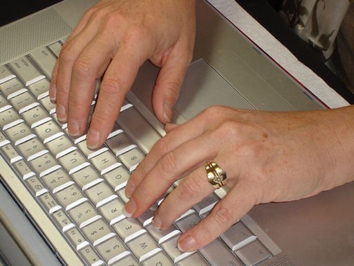 Finger Prosthesis